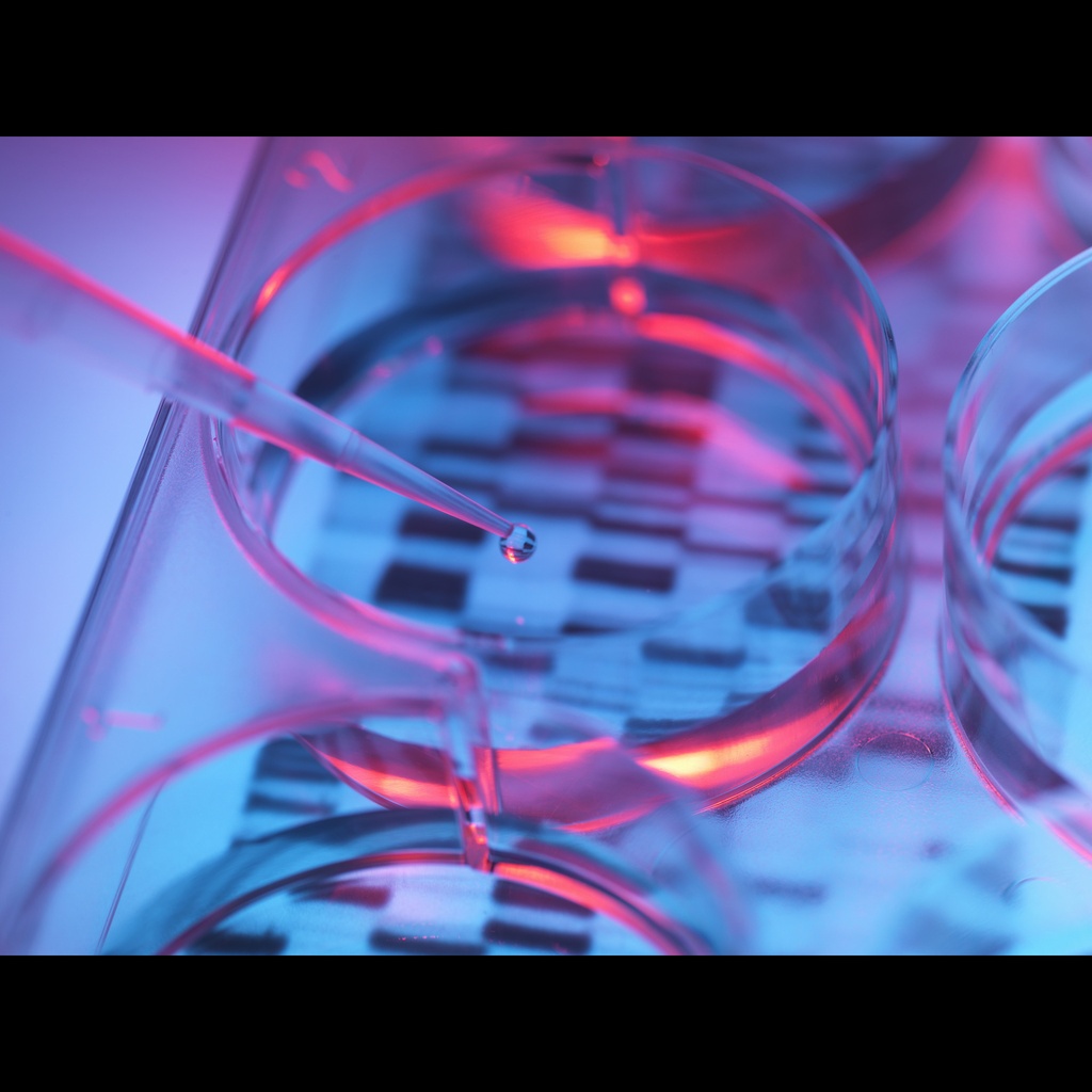 Amplirun Coccidioides Immitis DNA Control 10,000size:20,000 c/µL